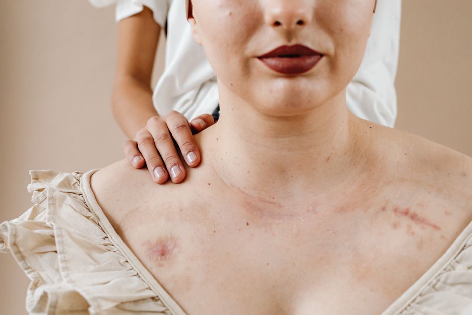 Why Your Skin Clears on Walking Rest Days and How Recovery Builds Complexion From Within